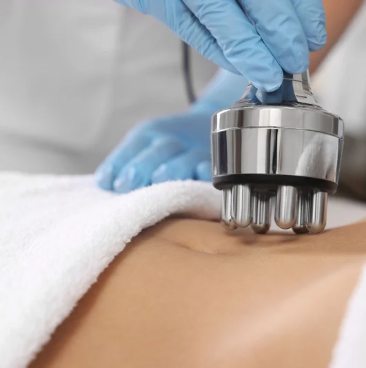 Fat Reduction Treatments in Islamabad