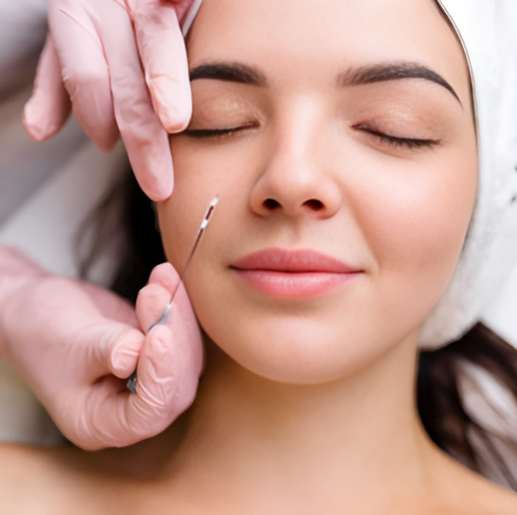 Thread Lift in Islamabad – The Ultimate Non-Surgical Facelift