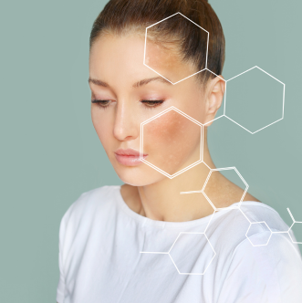 Skin Brightening Treatments in Islamabad