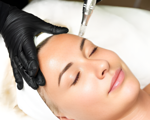 Effective Microneedling Services